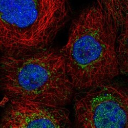 ENY2 Antibody, Novus Biologicals 25 &mu;L; Unlabeled:Antibodies, Polyclonal